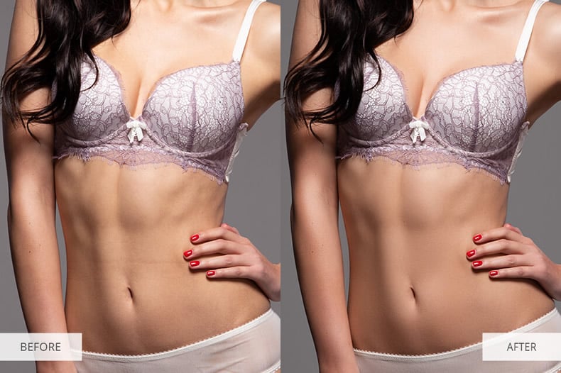 body-photo-retouching-matching-skin-tones-before-after